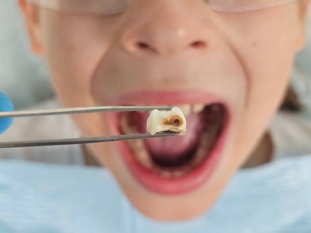 Best Orthodontic Emergency Dentist in Cushing, OK